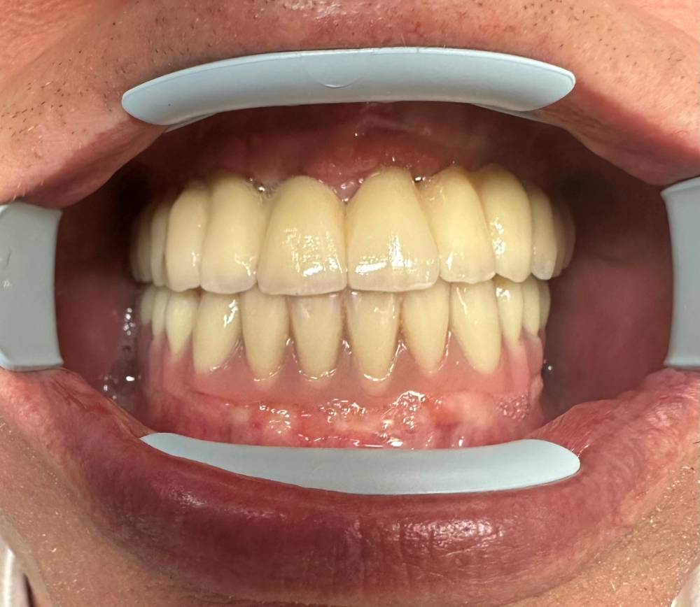 cas adam septembre 2025